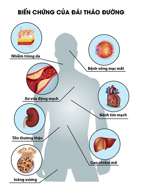 Bệnh tiểu đường giai đoạn cuối – Đâu là phương pháp chăm sóc hiệu quả ...